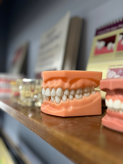 model of a dental implant on a shelf at Lisa Siddall, DDS office