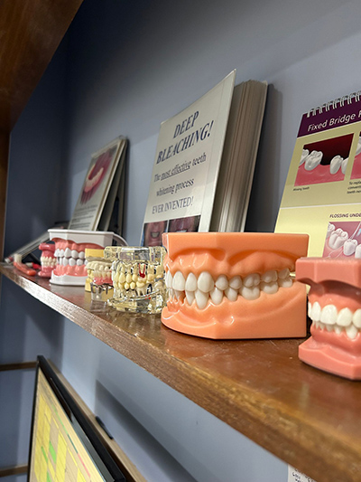 various types of dentures displayed at the office of Lisa Siddall, DDS